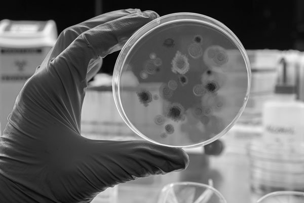 Petri dish containing a virus being held